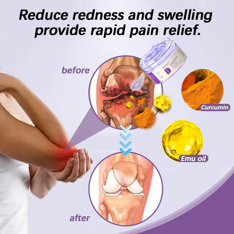 Official Store :✅ Ropceer™ Turmeric & Emu Oil Arthritis Soothing Pain Relief Massage Gel🦴🇺🇸American Orthopaedics (AAOS) Approved
