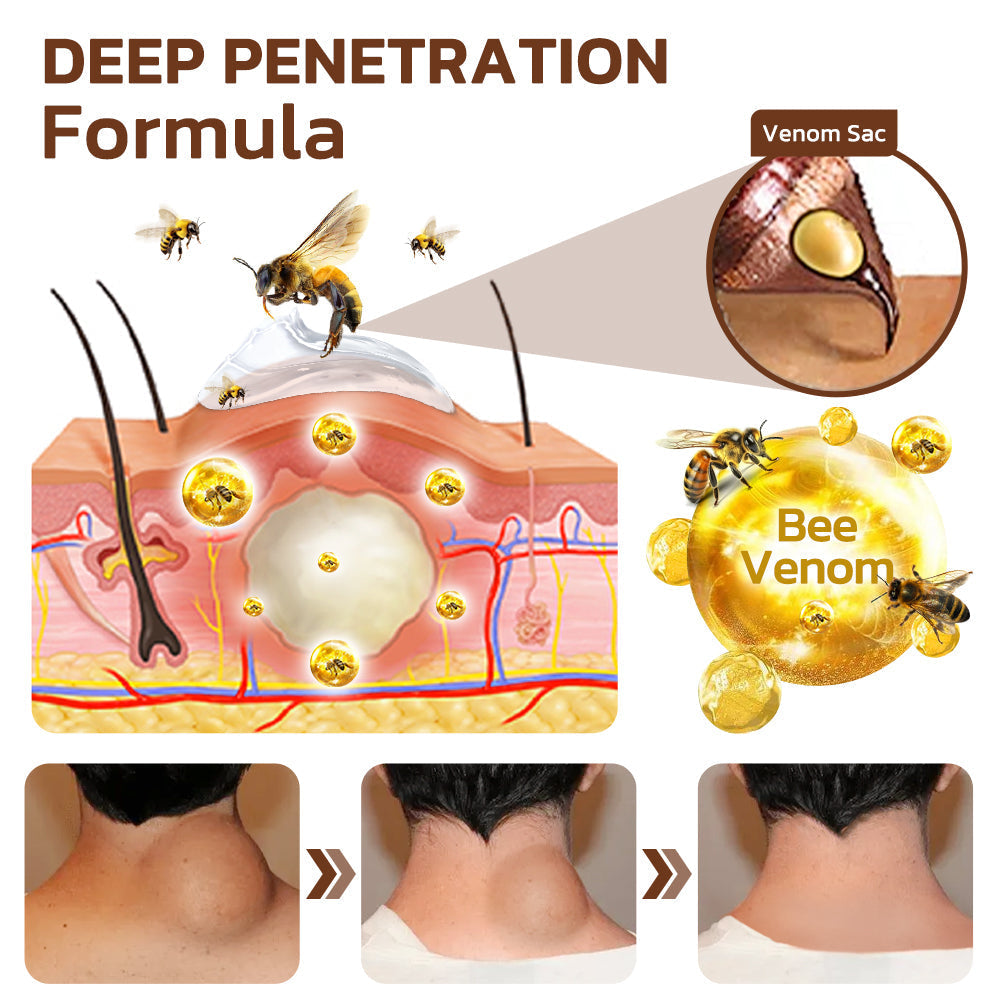 Cvreoz™ 🍯 Maryanni Bee Venom Lymphatic Recovery Cream
