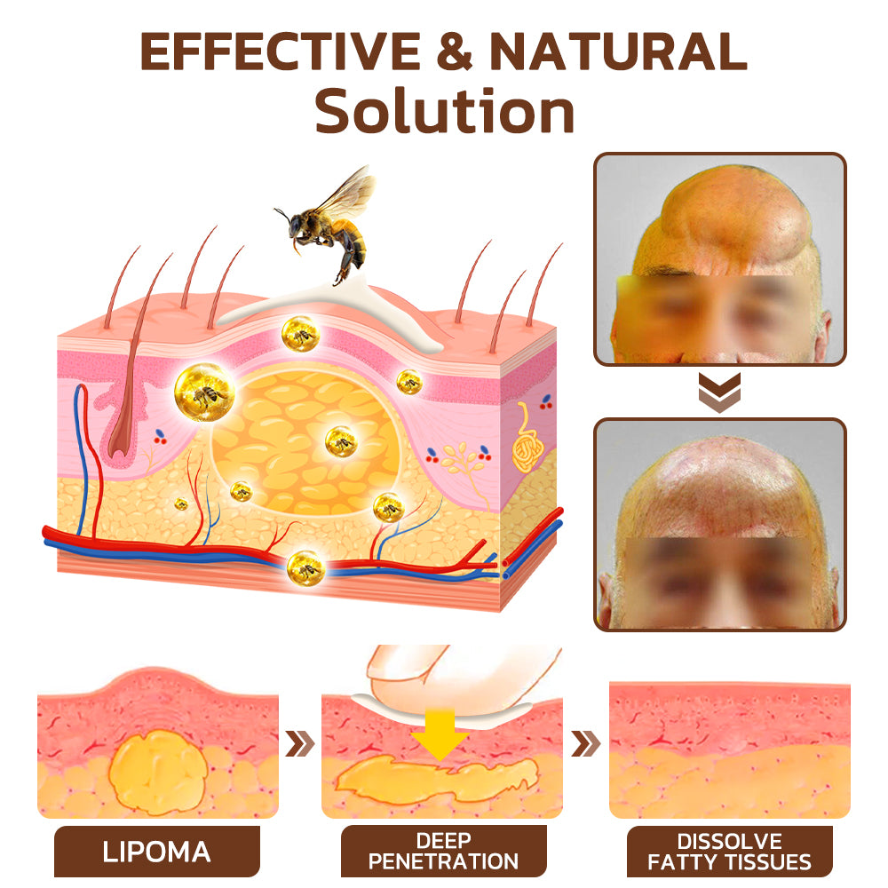 Cvreoz™ 🍯 Maryanni Bee Venom Lymphatic Recovery Cream
