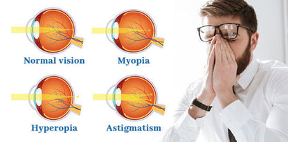 THONESR™ Vision recovery eye drops — 🥳Suitable For Various Eye Conditions✨