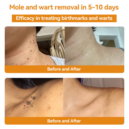 Turonu™ Bee Venom Skin Treatment Cream👩🏼‍⚕️（𝐴𝐴𝐷 𝑅𝑒𝑐𝑜𝑚𝑚𝑒𝑛𝑑𝑒𝑑） (🔥𝑳𝒂𝒔𝒕 𝒅𝒂𝒚 𝒑𝒓𝒐𝒎𝒐𝒕𝒊𝒐𝒏 80% 𝒐𝒇𝒇)