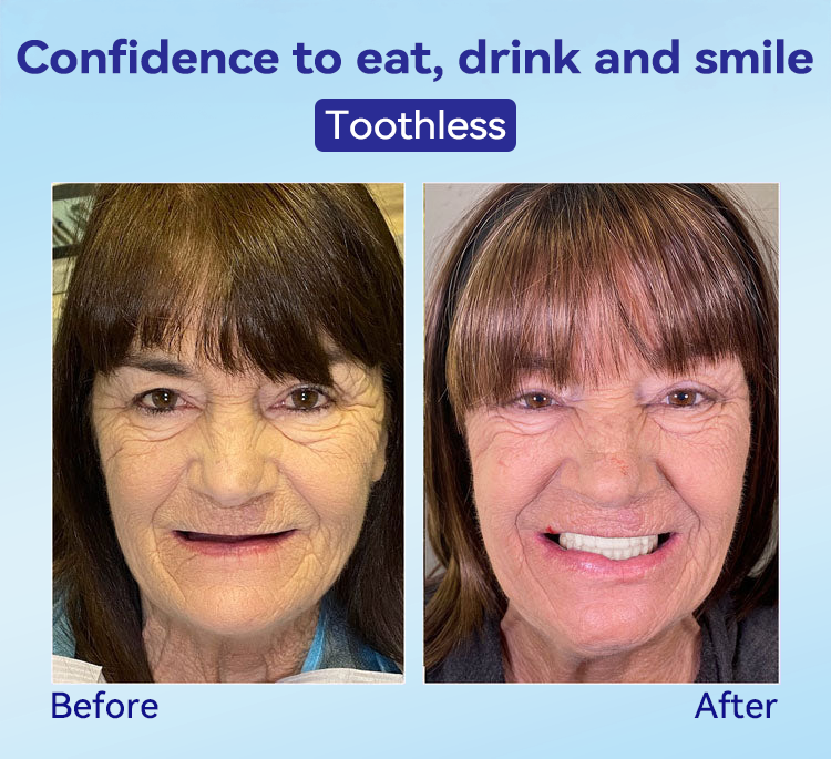 𝐁𝐢𝐤𝐞𝐧𝐝𝐚®🍀𝐏𝐫𝐞𝐦𝐢𝐮𝐦 𝐃𝐞𝐧𝐭𝐮𝐫𝐞(🦷𝐋𝐢𝐦𝐢𝐭𝐞𝐝 𝐭𝐢𝐦𝐞 𝐝𝐢𝐬𝐜𝐨𝐮𝐧𝐭 𝐋𝐚𝐬𝐭 𝟑𝟎 𝐦𝐢𝐧𝐮𝐭𝐞𝐬🦷)