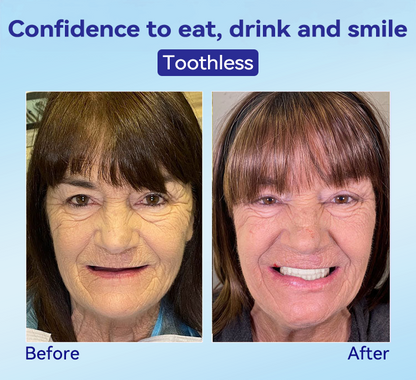 𝐁𝐢𝐤𝐞𝐧𝐝𝐚®🍀𝐏𝐫𝐞𝐦𝐢𝐮𝐦 𝐃𝐞𝐧𝐭𝐮𝐫𝐞(🦷𝐋𝐢𝐦𝐢𝐭𝐞𝐝 𝐭𝐢𝐦𝐞 𝐝𝐢𝐬𝐜𝐨𝐮𝐧𝐭 𝐋𝐚𝐬𝐭 𝟑𝟎 𝐦𝐢𝐧𝐮𝐭𝐞𝐬🦷)