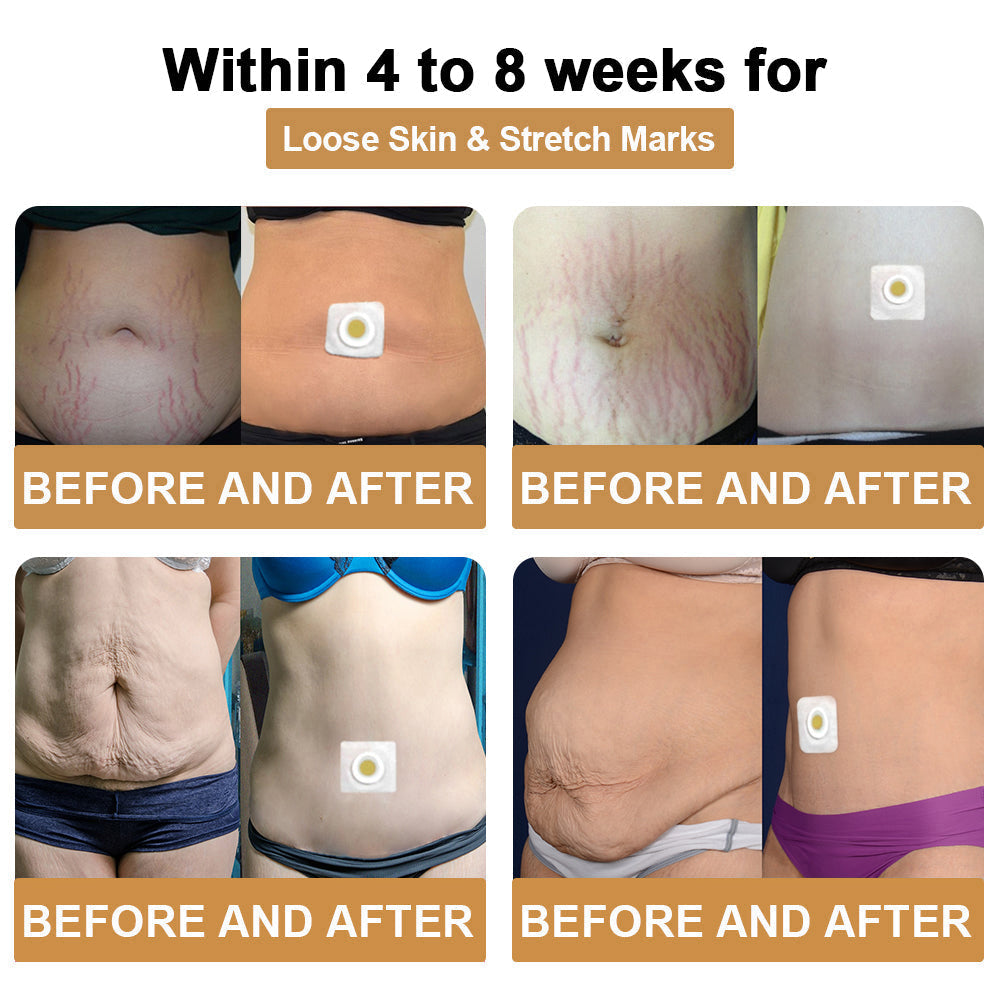 Cvreoz ™ 𝐁ee 𝐯𝐞𝐧𝐨𝐦 𝐥𝐲𝐦𝐩𝐡𝐚𝐭𝐢𝐜 𝐝𝐫𝐚𝐢𝐧𝐚𝐠𝐞 𝐬𝐥𝐢𝐦𝐦𝐢𝐧𝐠 𝐩𝐚𝐭𝐜𝐡 ⭐🧈((𝐟𝐨𝐫 𝐚𝐥𝐥 𝐥𝐲𝐦𝐩𝐡𝐚𝐭𝐢𝐜 𝐩𝐫𝐨𝐛𝐥𝐞𝐦𝐬 𝐚𝐧𝐝 𝐨𝐛𝐞𝐬𝐢𝐭𝐲）