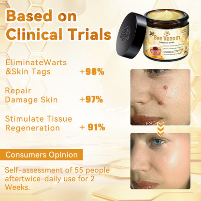 Turonu™ Bee Venom Skin Treatment Cream👩🏼‍⚕️（𝐴𝐴𝐷 𝑅𝑒𝑐𝑜𝑚𝑚𝑒𝑛𝑑𝑒𝑑） (🔥𝑳𝒂𝒔𝒕 𝒅𝒂𝒚 𝒑𝒓𝒐𝒎𝒐𝒕𝒊𝒐𝒏 80% 𝒐𝒇𝒇)