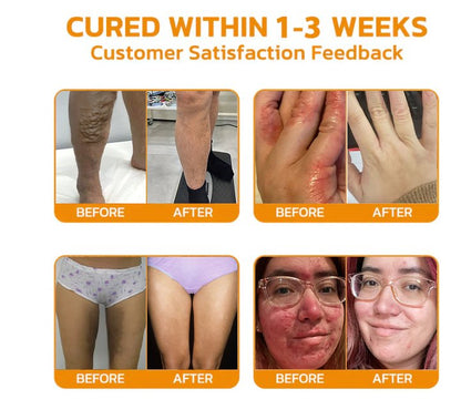[Official Brand Store]🐴2025 New Horse Oil Therapy Cream (👨‍⚕FDA 𝐑𝐄𝐂𝐎𝐌𝐌𝐄𝐍𝐃𝐒)